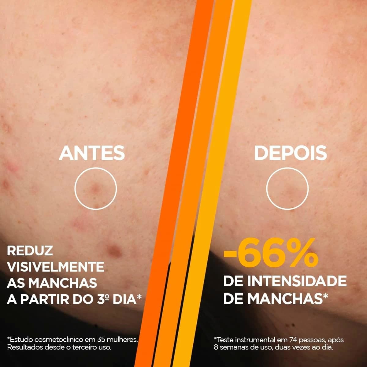 Garnier Sérum Facial Antimarcas Vitamina C, Niacinamida e Ácido Salicílico 30ml