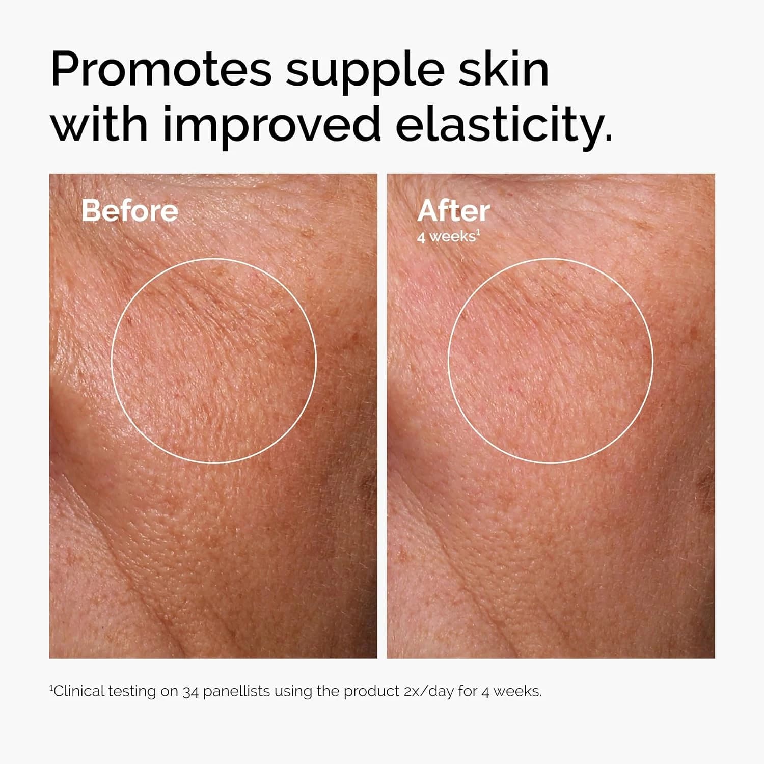 The Ordinary, Ácido Hialurônico 2% + B5
