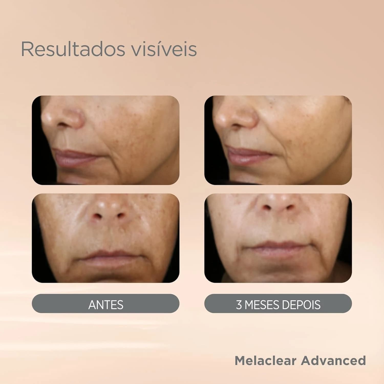 ISDIN Sérum Facial Clareador Anti-Idade Isdinceutics Melaclear Advanced - 30 ml
